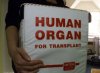 human organ transplant.jpg