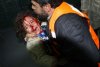 A wounded child in Gaza after Israel's attack 6 months past..jpg