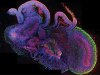 cerebral-organoid-brain-grown-in-a-jar-640x412.jpg