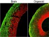 Comparison_organoid_and_mouse_brain-640x412.jpg