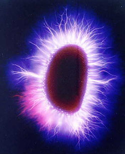 Kirlian_thumb_after.jpg